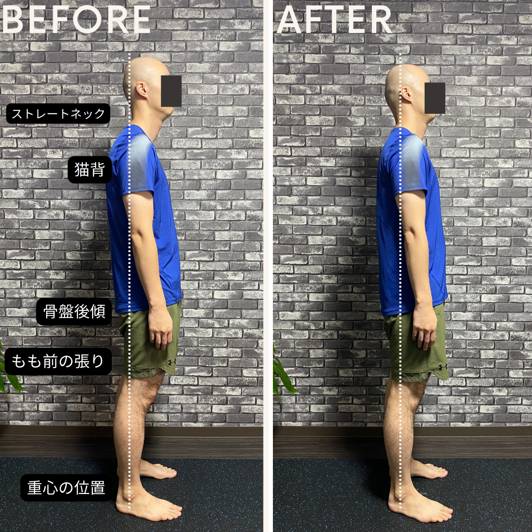 姿勢改善 BEFORE/AFTER 男性