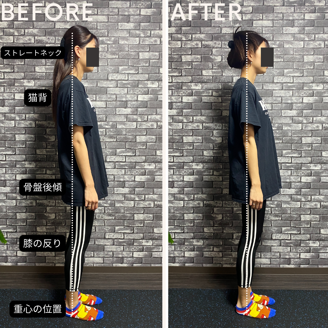 姿勢改善 BEFORE/AFTER 女性